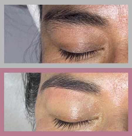 Women Before and After Eyebrow Waxing